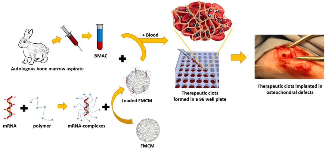 Therapeutic blood clots activated by mRNA could cushion the blow of osteoarthritis